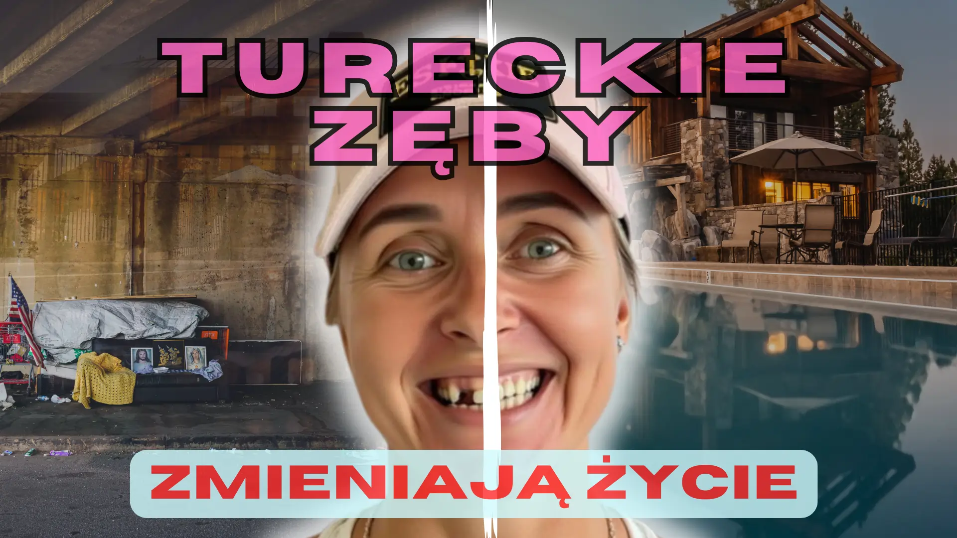 Tureckie_zęby_zmieniają_życie_2