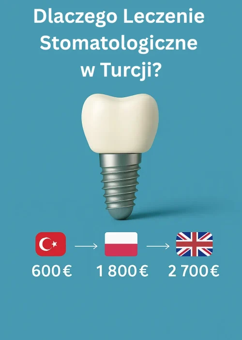 Dlaczego Leczenie Stomatologiczne w Turcji?